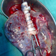 Image for article titled The questionable nutritional value of eating a human placenta